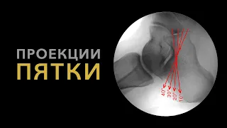 Выполнение рентгенограмм пяточной кости