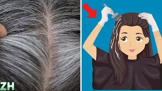 ⚠️Most Common Causes of Grey Hair That You Must Know