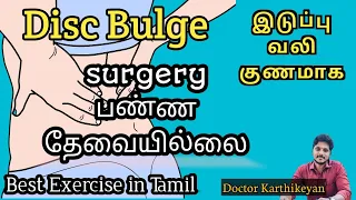 Disc Bulge  அடிமுதுகு வலி காரணங்களும் அதன் தீர்வும்| Best important Exercises ... No need surgery..