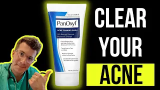Doctor explains how to use BENZOYL PEROXIDE for ACNE (aka PanOxyl / Acnecide) | Side effects & more