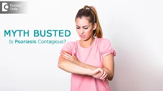 MYTH BUSTED | How is psoriasis transmitted ? Is it contagious?- Dr. Chaithanya K S | Doctors' Circle