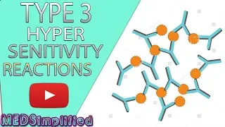 Type 3 Hypersensitivity Made Easy -  Immunology