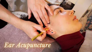 Special EAR MASSAGE and ACUPUNCTURE For YOU, Soft Spoken ASMR