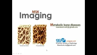 Imaging of Metabolic bone diseases (I) (DRE) Prof. Mamdouh Mahfouz