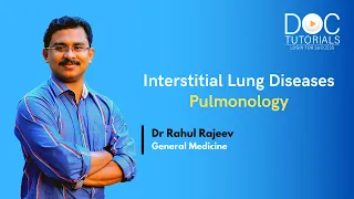 Interstitial Lung Diseases Explained By Dr. Rahul Rajeev | Pulmonology | NEET PG | DocTutorials