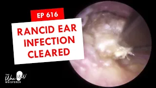 616 - Rancid Ear Infection Cleared