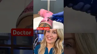 Doctor reacts: cast removal gone wrong