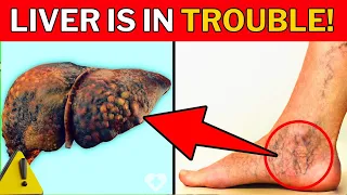 Warning: 9 Foot Signs Your Liver Is in Serious Trouble!