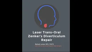 Laser Zenker’s Diverticulum Treatment Through the Mouth - Quick & Easy Recovery