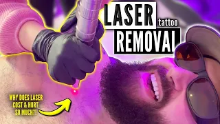 “how many laser sessions does it take to remove a tattoo” Q&A w. CERTIFIED laser tech