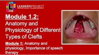 Module 1.2- Cleft Palate Speech and Feeding: Anatomy and Physiology of Cleft Lip and Palate