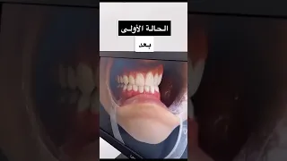 صفوة المهيدب في الجبيل