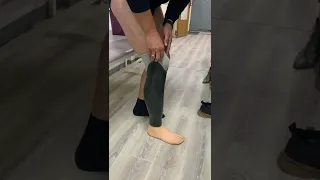 Протезирование ног №2