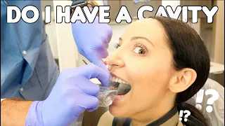 Dental Hygienist Finds A Cavity On Her X-rays (incipient decay)