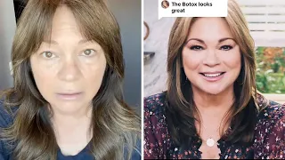 Valerie Bertinelli Claps Back: Embracing Body Positivity Amid Botox Accusations
