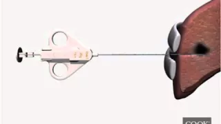 Quick Core Biopsy Needles  Device Animation