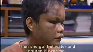 Malaysia Most Horrible Indonesian Maid Abused News Report P2