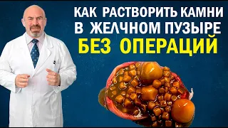 📌 Как растворить Камни в Желчном Пузыре и Печени | Избавиться от желчекаменной болезни без операций