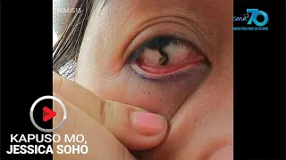 Kapuso Mo, Jessica Soho: Linta, pumasok sa mata!