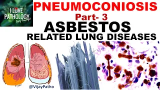 PNEUMOCONIOSIS Part 3: ASBESTOS related lung diseases