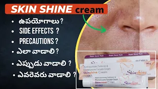 SkinShine Cream review in telugu | Best medicine to treat Melasma ~ Uses & how to use(blackpatches)