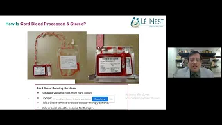 Cord Blood Banking | Preserving Your Baby’s Umbilical Cord Blood - Luxury or Essential?
