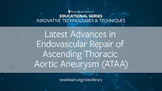 Episode 5 | Latest Advances in Endovascular Repair of Ascending Thoracic Aortic Aneurysm (ATAA)
