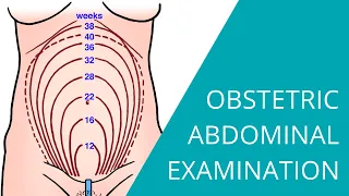 Obstetric Abdominal Examination - Steps for examining a pregnant woman