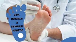 Diabetul Zaharat: 10 Sfaturi ca sa NU Ajungi la Amputatie