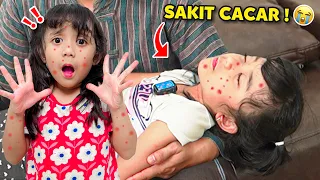 SAMANTHA SAKIT CACAR AIR SAMPAI PINGSAN BIKIN SEMUA ORANG PANIK DAN DIBAWA KE RUMAH SAKIT !!