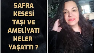 MİDE İLE BAŞLAYAN SAFRA KESESİ AMELİYAT SÜRECİM ÖNCESİ SONRASI TÜM ÖĞRENDİKLERİM