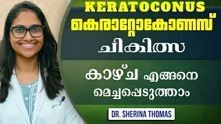 KERATOCONUS എന്ന രോഗത്തിന് ചികിത്സയുണ്ടോ? | keratoconus treatment | keratoconus malayalam | c3r