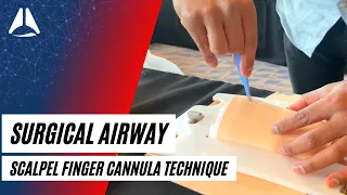 Scalpel Finger Cannula technique in CICO emergencies | Airway Management