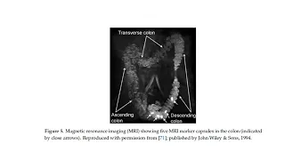 Colonic transit study