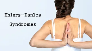 The Ehlers-Danlos Syndromes (EDS)