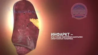 M044   Некроз және апоптоз