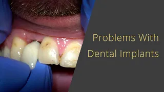 Dental Implant Problems