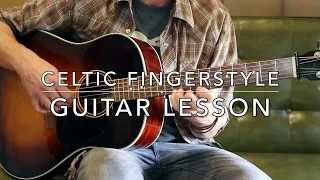 The Road To Lisdoonvarna: Guitar Lesson (Celtic Fingerstyle)