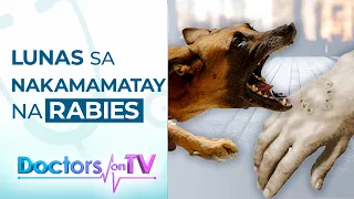 ALAMIN: Mga sintomas at paraan para maiwasan ang panganib na dulot ng ‘Rabies’ | DOTV