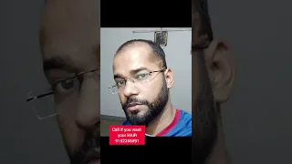 Baldness Problem No Problem | Hair Transplant Result #shorts