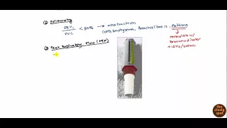 Asthma for USMLE Step 2