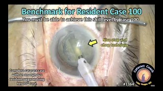 CataractCoach 1364: benchmark for resident case 100