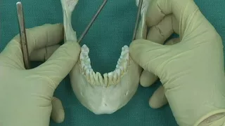 1.14 Step 10.  Mandible