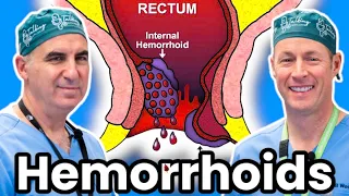 Hemorrhoids - What Are They and How To Get Rid Of Them With And Without Surgery