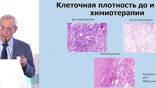 Локальное (хирургическое и лучевое) лечение рака молочной железы. Принципы St.Gallen конференции