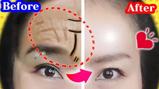 Tighten and Remove Forehead & Frown Wrinkles in 7 DAYS 🤗 Massage & Exercises