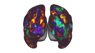 MRI Research Decoding the Human Brain