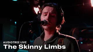 The Skinny Limbs - Rosebud | Audiotree Live