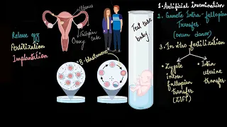 In vitro fertilization and surrogacy | Reproductive health | Biology | Khan Academy
