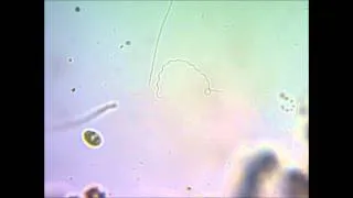 Спирулина под микроскопом under microscope